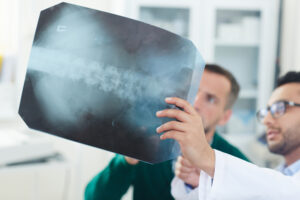 Spinal Cord Injury Aftermath - Temple Injury Law