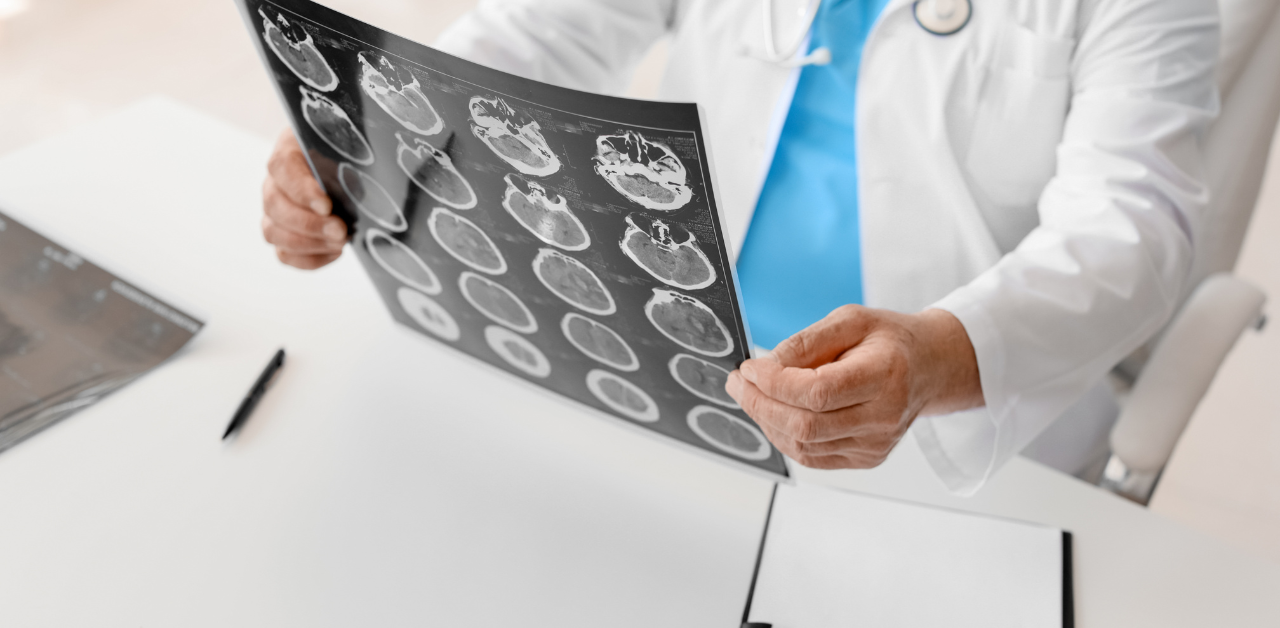 A doctor holds a brain scan with multiple images of the brain, examining them at a desk